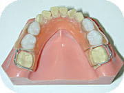 小児義歯保険装置